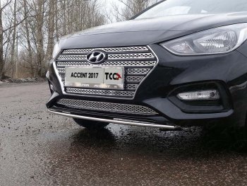 1 000 000 р.  ТСС Тюнинг HYUNDAIAccent 2017- - Решетка радиатора нижняя (лист)  hyunacc1718  с доставкой в г. Воронеж. Увеличить фотографию 1